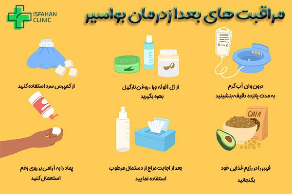 مراقبت‌های بعد از لیزر بواسیر