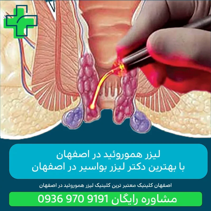 عمل بای پس معده در اصفهان