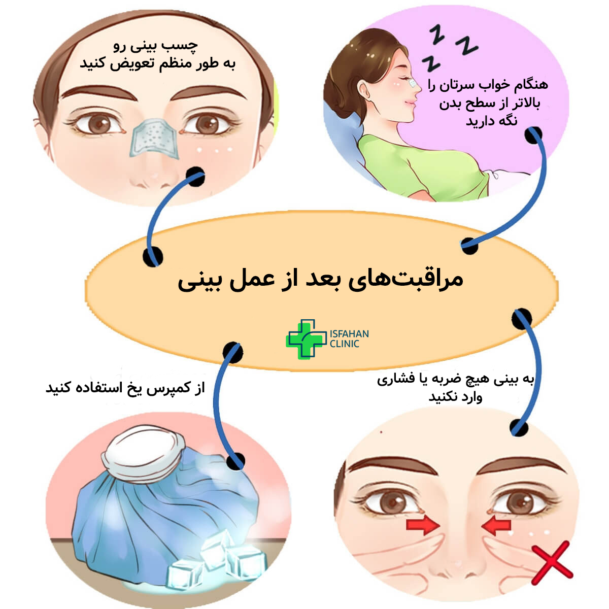 مراقبتهای بعد از عمل بینی توصیه برای مراقبت پس از عمل بینی