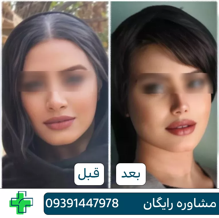 بهترین دکتر عمل بینی در اصفهان برای عمل بینی بهترین دکتر عمل بینی در اصفهان برای عمل بینی