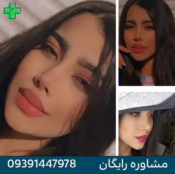 بهترین دکتر عمل بینی در اصفهان برای عمل بینی بهترین دکتر عمل بینی در اصفهان برای عمل بینی