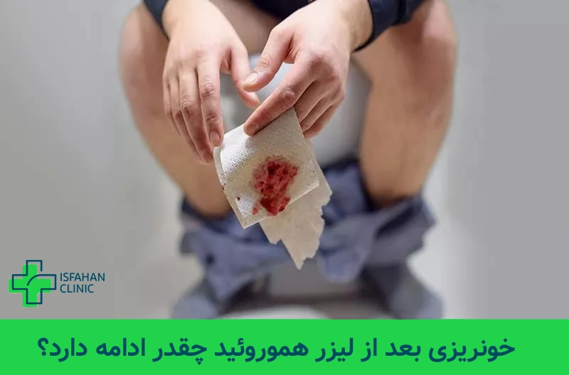 خونریزی بعد از لیزر هموروئید چقدر ادامه دارد؟ خونریزی بعد از لیزر هموروئید چقدر ادامه دارد؟