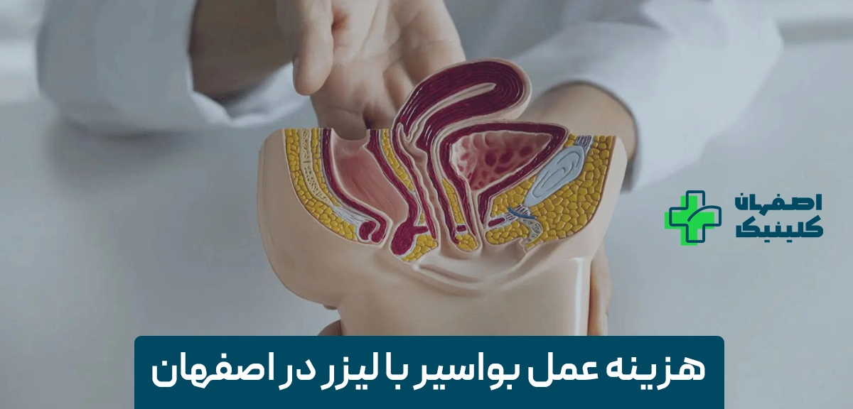 هزینه عمل بواسیر با لیزر در اصفهان هزینه عمل بواسیر با لیزر در اصفهان
