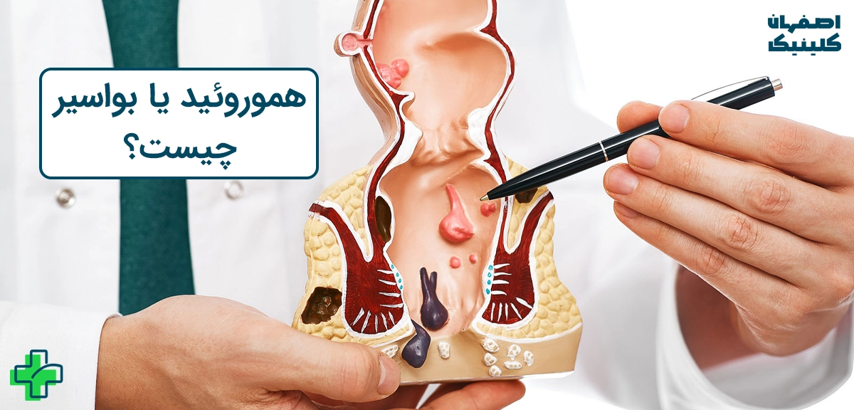 هموروئید چیست؟ هموروئید چیست