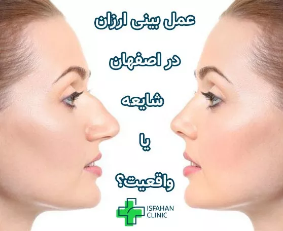 هزینه عمل بینی در اصفهان هزینه عمل بینی در اصفهان