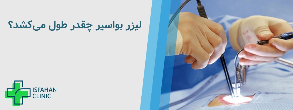 لیزر بواسیر چقدر طول می‌کشد؟