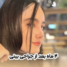 بهترین دکتر عمل بینی در اصفهان برای عمل بینی بهترین دکتر عمل بینی در اصفهان برای عمل بینی