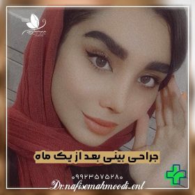 بهترین دکتر عمل بینی در اصفهان برای عمل بینی بهترین دکتر عمل بینی در اصفهان برای عمل بینی