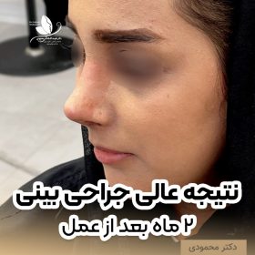 بهترین دکتر عمل بینی در اصفهان برای عمل بینی بهترین دکتر عمل بینی در اصفهان برای عمل بینی