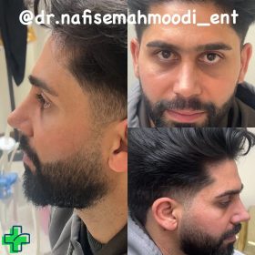 بهترین دکتر عمل بینی در اصفهان برای عمل بینی بهترین دکتر عمل بینی در اصفهان برای عمل بینی