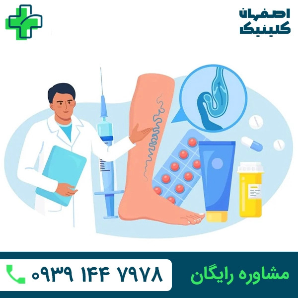 درمان واریس با لیزر در اصفهان درمان واریس با لیزر در اصفهان
