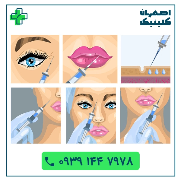 تزریق بوتاکس در اصفهان با بهترین دکتر بوتاکس اصفهان تزریق بوتاکس در اصفهان با بهترین دکتر بوتاکس اصفهان