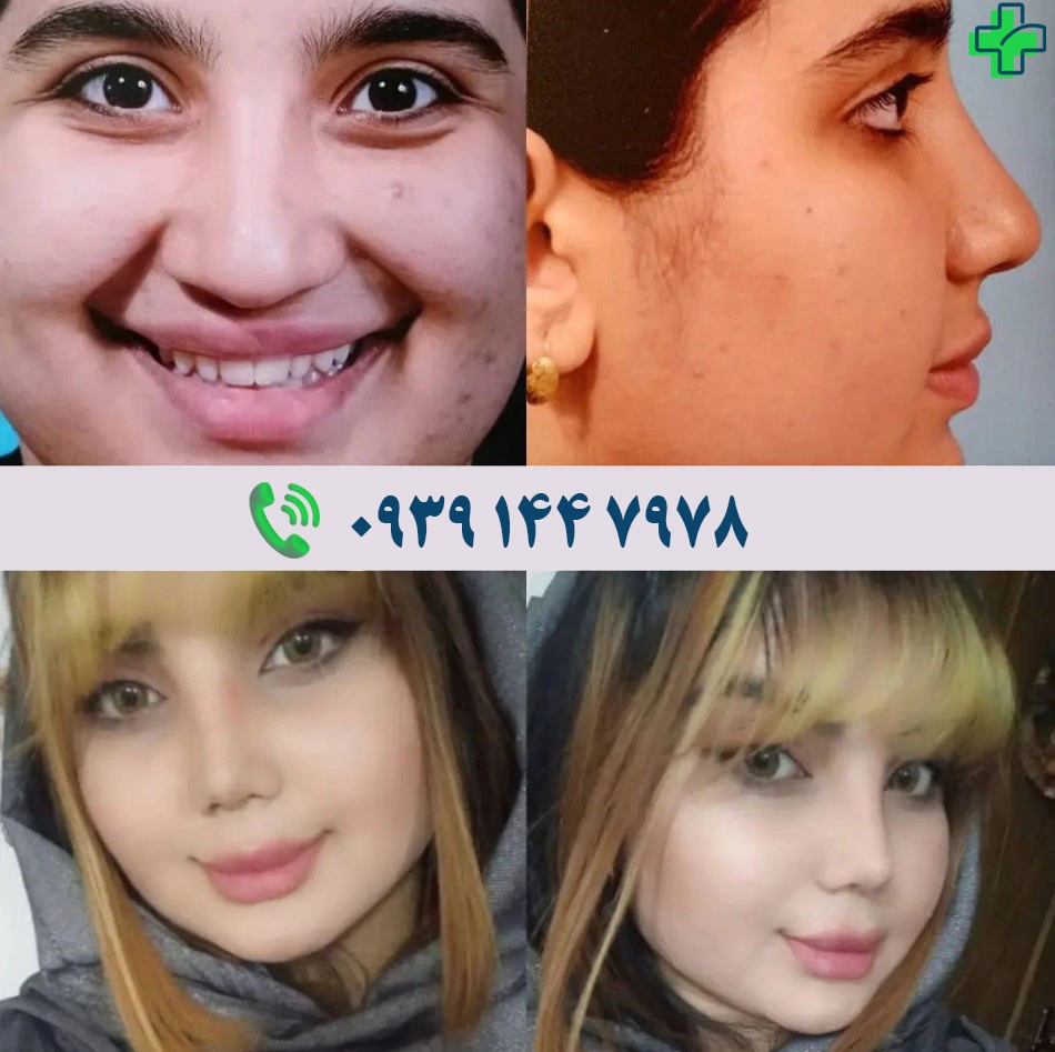 بهترین دکتر عمل بینی در اصفهان برای عمل بینی بهترین دکتر عمل بینی در اصفهان