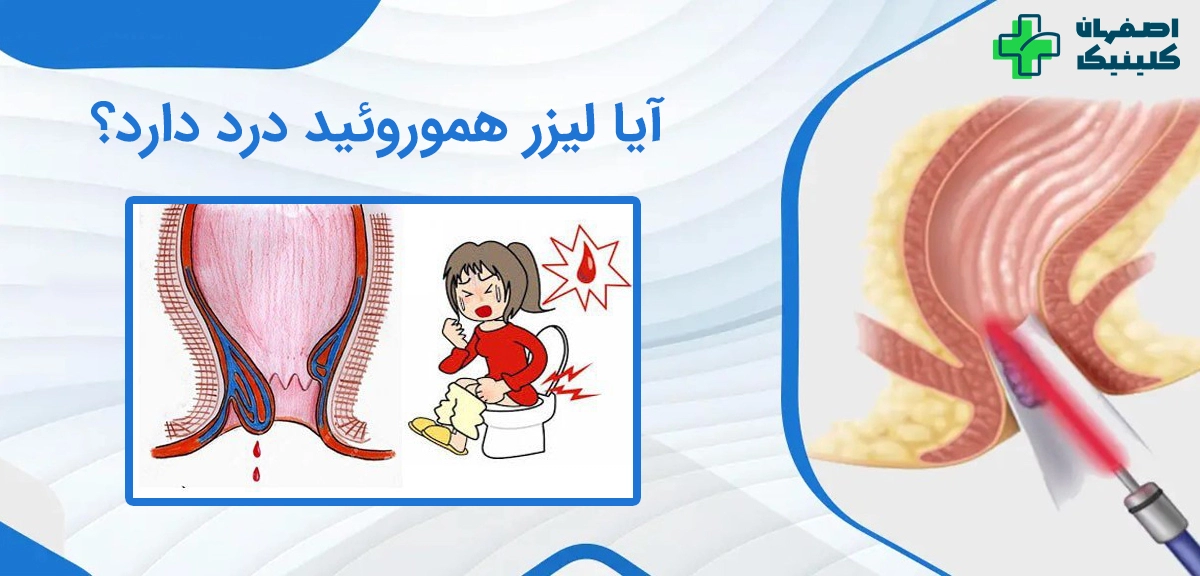 آیا لیزر هموروئید درد دارد؟ آیا لیزر هموروئید درد دارد؟