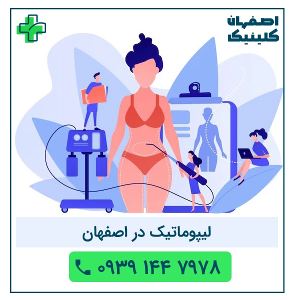لیپوماتیک در اصفهان با بهترین جراح لیپوماتیک در اصفهان متد 2025 لیپوماتیک در اصفهان