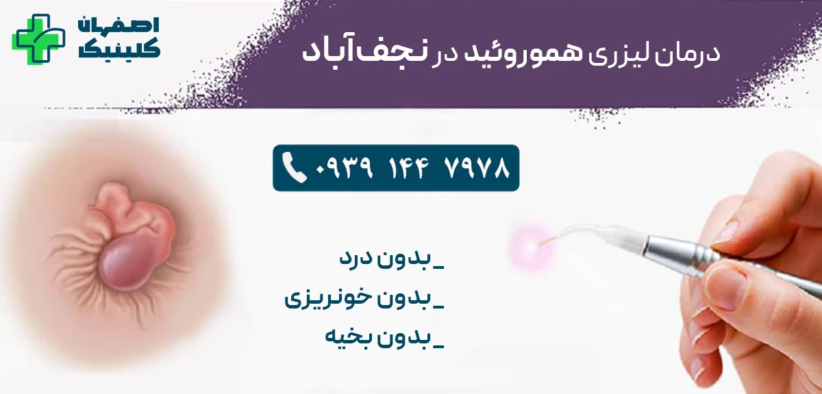 درمان_لیزری_هموروئید_در_نجف‌آباد