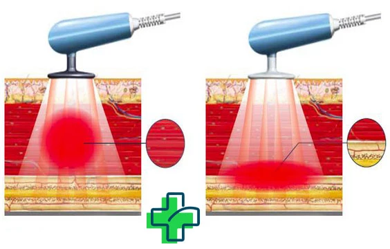 بهترین مرکز تکار تراپی اصفهان
