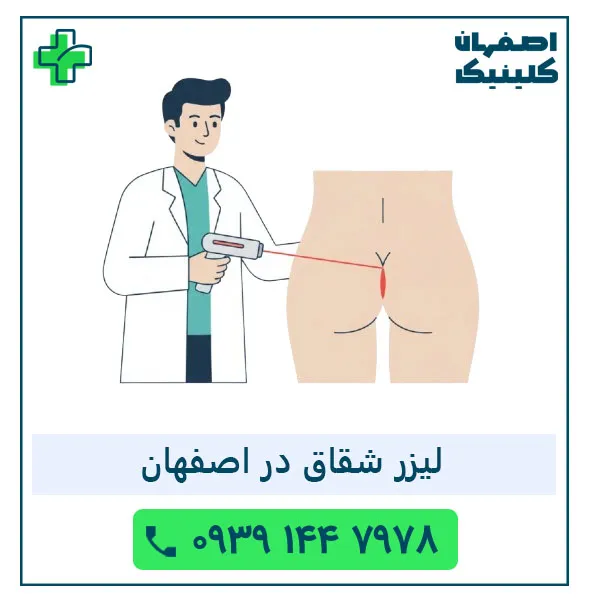 بهترین دکتر لیزر شقاق در اصفهان در سال 1404 | لیزر دائمی شقاق لیزر شقاق در اصفهان