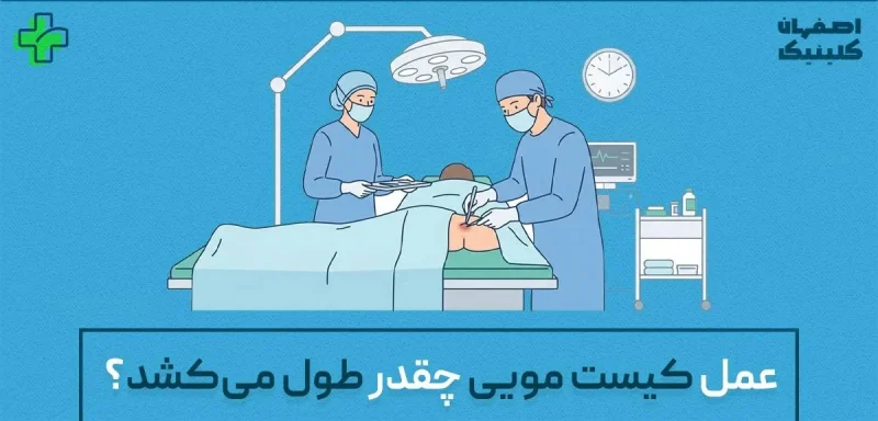 عمل کیست مویی چقدر طول می_کشد؟