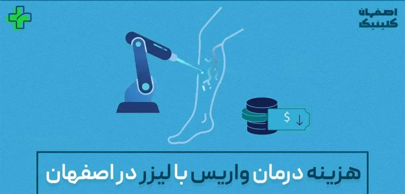 هزینه درمان واریس با لیزر در اصفهان
