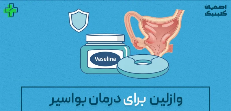 وازلین برای درمان بواسیر؛ آیا واقعاً موثر است؟