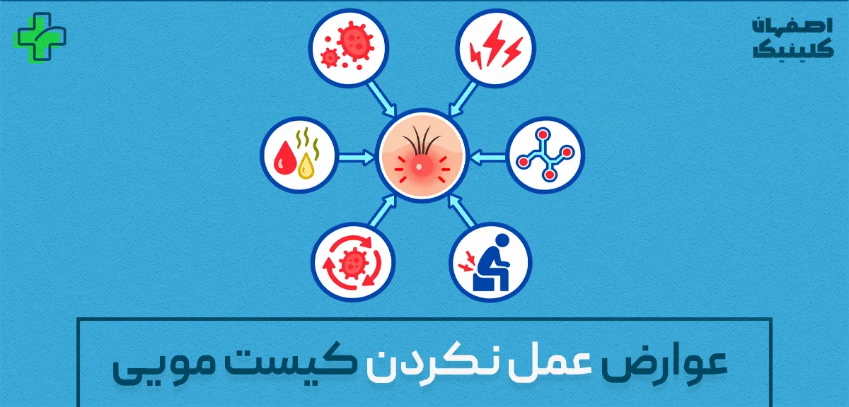 عوارض عمل نکردن کیست مویی چیست؟ خطرات تأخیر در درمان عوارض عمل نکردن کیست مویی چیست؟ خطرات تأخیر در درمان