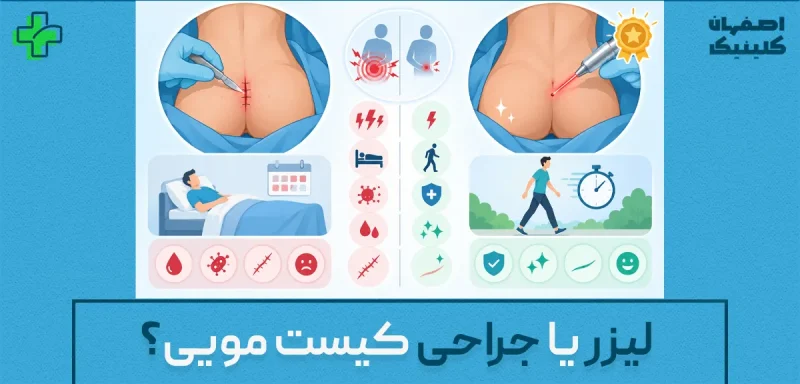 لیزر یا جراحی کیست مویی؟ مقایسه درد، مزایا و بهترین روش