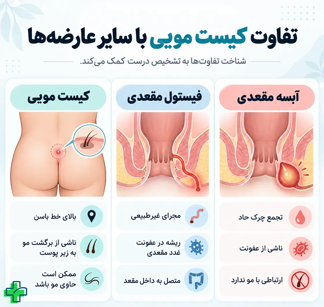 کیست مویی چیست؟ انواع و محل ایجاد تفاوت کیست مویی با عارضه_های مقعدی